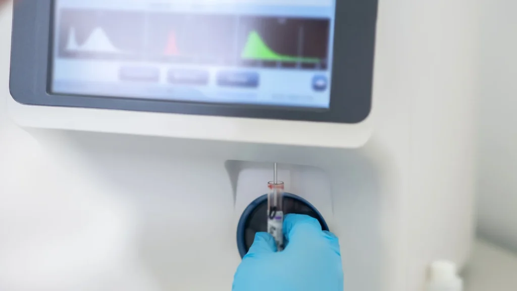 A close-up of a blood sample being inserted into a hematology analyzer, showcasing the simplicity and efficiency of point-of-care testing devices in providing immediate diagnostics.