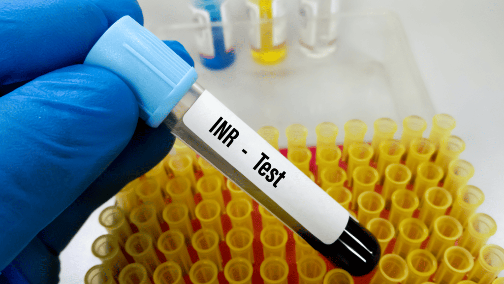 Understanding PT, aPTT, and INR in coagulation tests for diagnosing clotting disorders