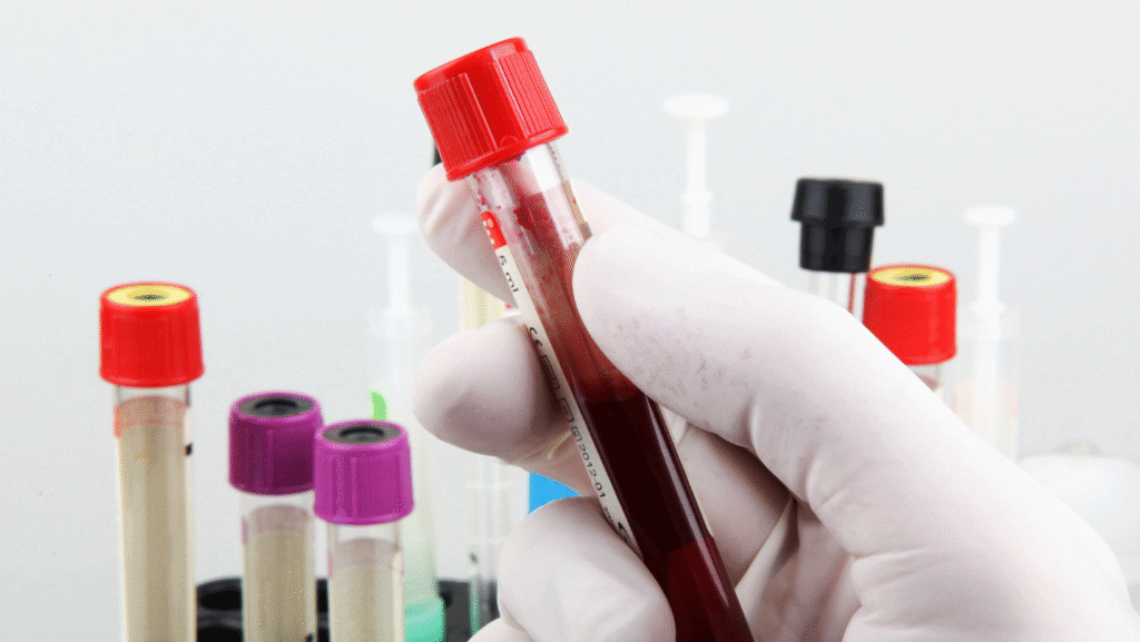 Technician conducting laboratory testing for infectious diseases