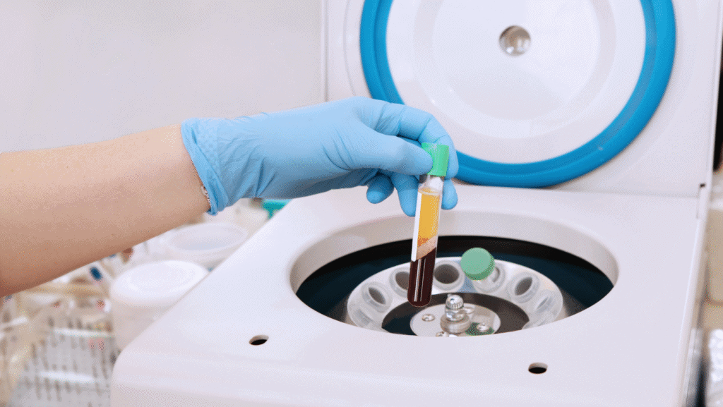 Automated diagnostic machines used in infectious disease testing