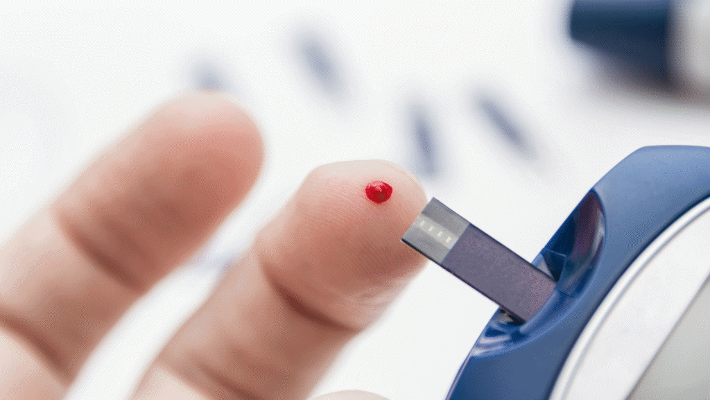 Hand-held HbA1c analyzer using capillary blood sample from finger prick