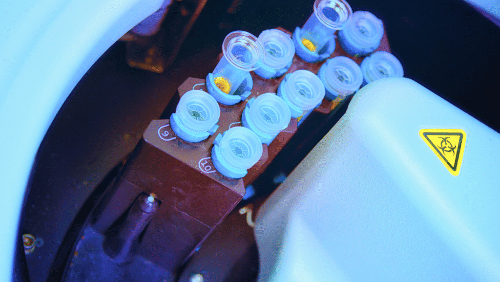 Blood sample testing workflow in automated chemistry analyzer