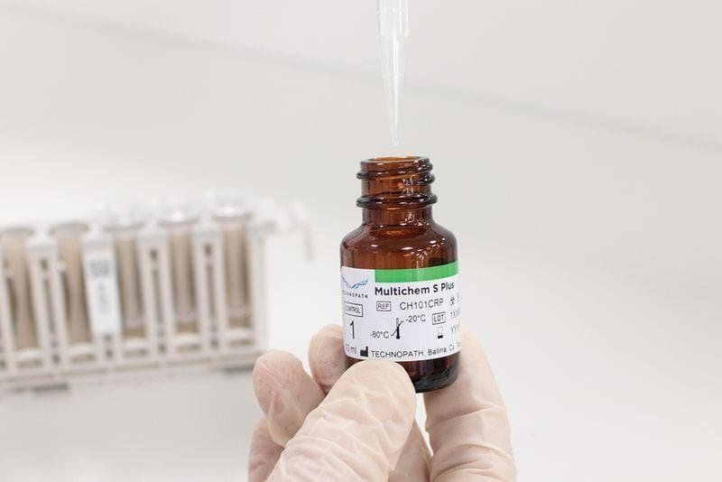 Laboratory reagent bottles used for clinical diagnostic testing and accurate specimen analysis.